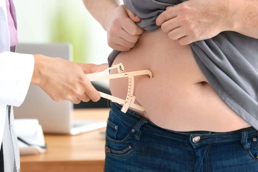 CIRURGIA BARIÁTRICA: COMO SABER SE SERVE PARA MIM